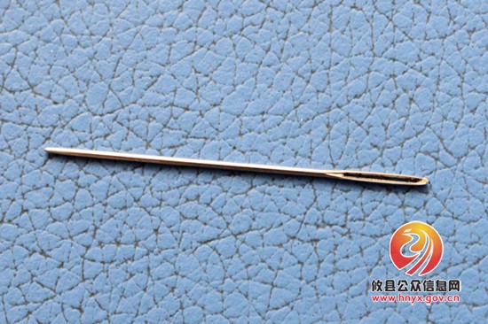 2岁幼童吞针命悬一线，县人民医院医护人员除异物化险为夷