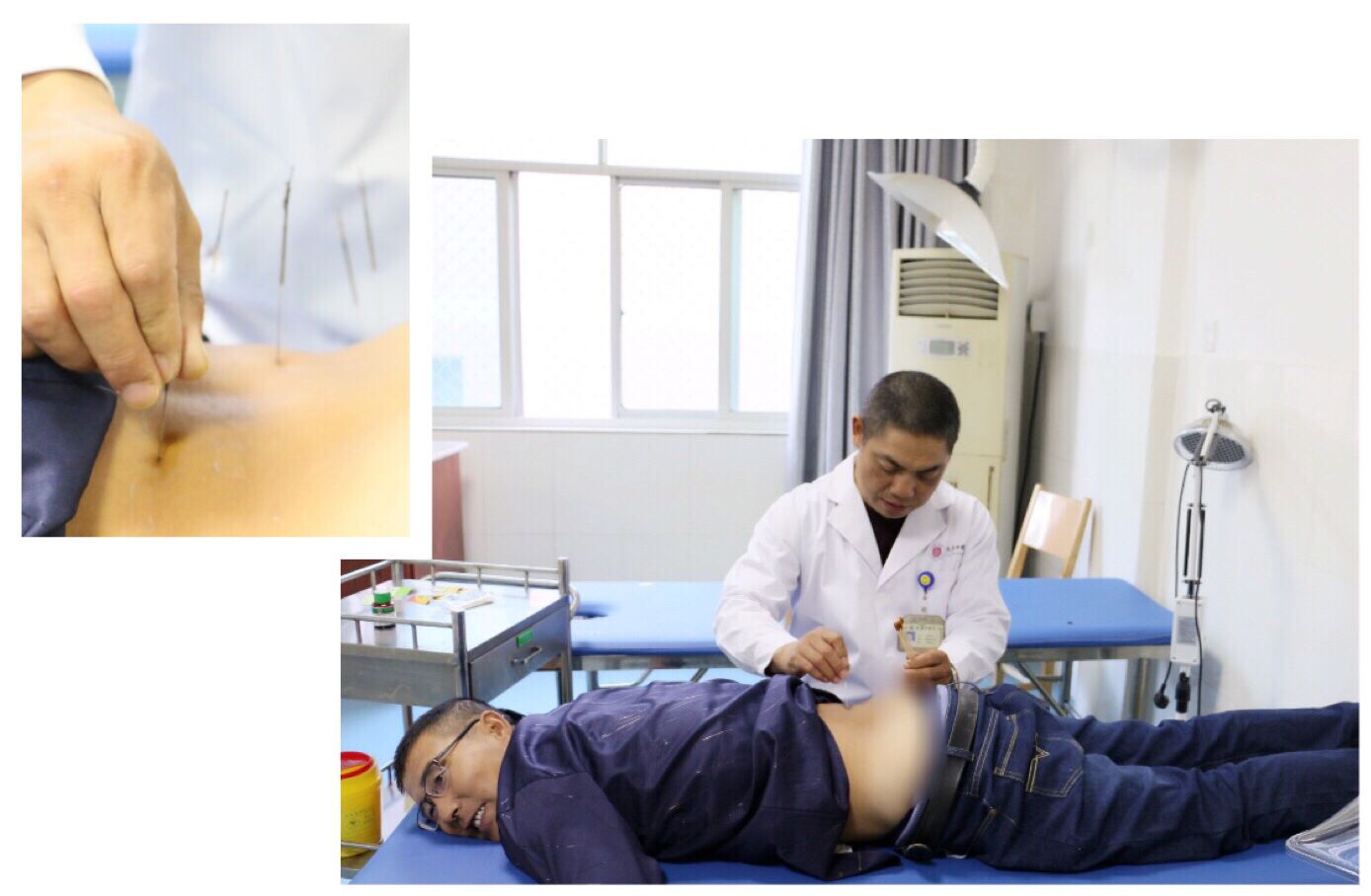 “小李飞刀”放大招！又一位内蒙古患者舍近求远慕名而来！