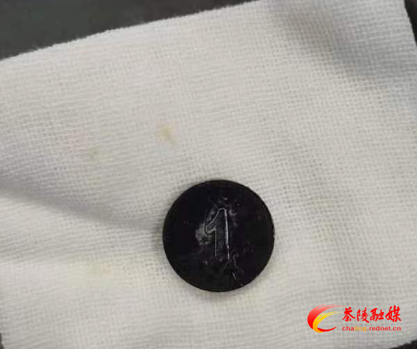 惊险！三岁宝宝误吞硬币数天 ，茶陵县中医医院成功取出化险为夷